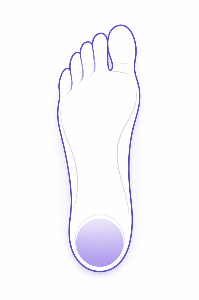 Heel Strike Pattern